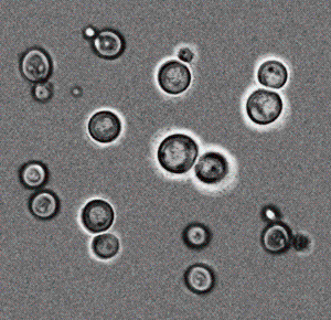 <em>H. polymorpha<em> photo courtesy of Dr. A.A. Sybirny.