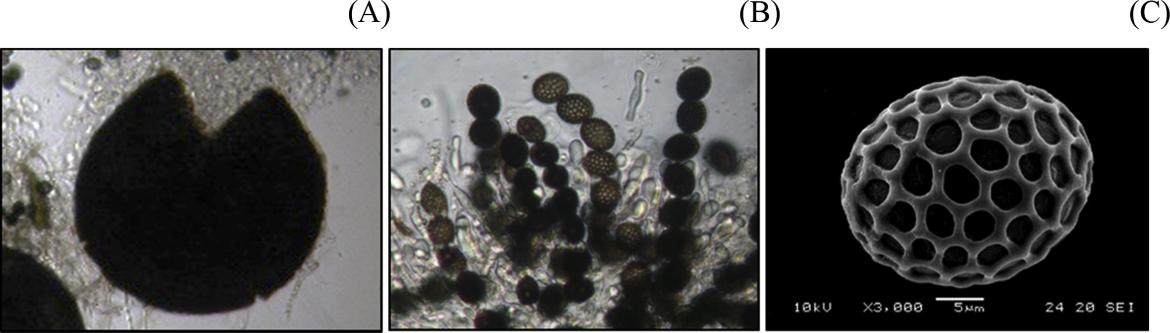 Non-ostiolate ascoma (1), asci (B) and ascospore (C) of Neurospora indica