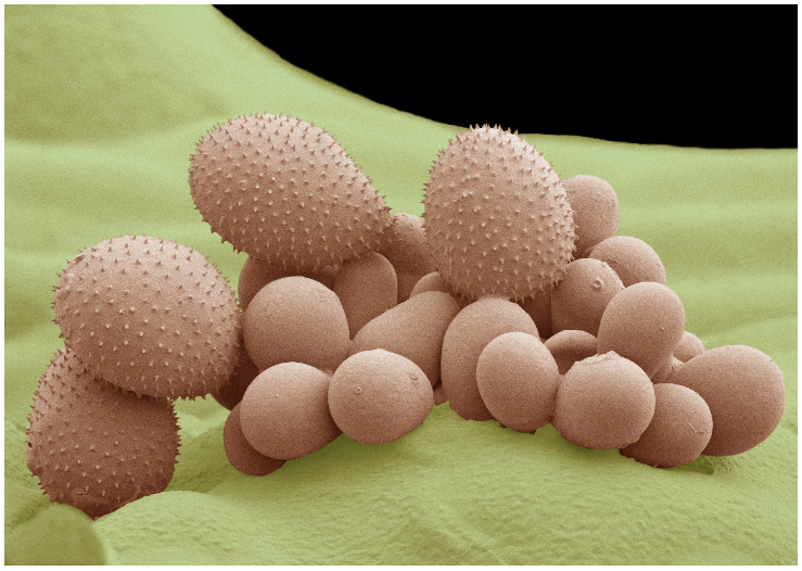 Scanning electron micrograph of a sporulating uredinium of P. pachyrhizi on the surface of a soybean leaf at 21 days post inoculation.